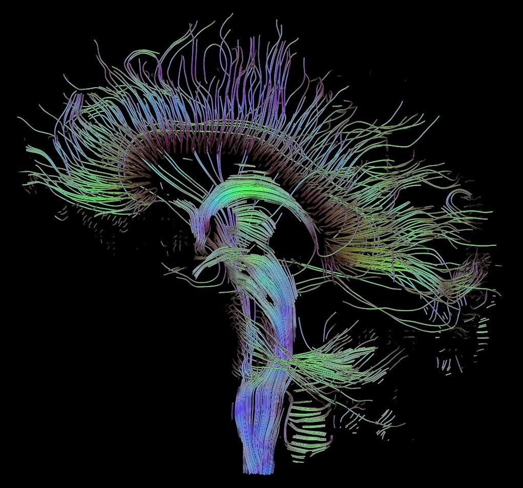 Diffusion tensor tractography of the human brain, showing white matter fiber tracts in a sagittal view