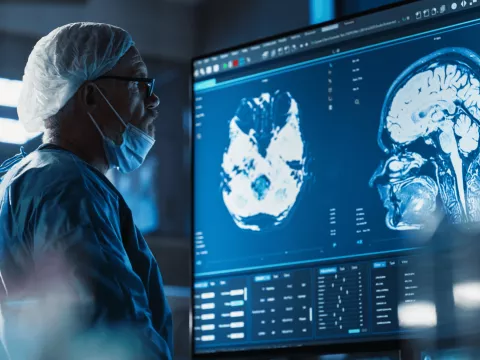 A neurosurgeon reviewing angiographic scans
